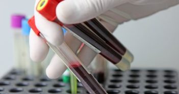 Совет муфтиев России проведет акцию «Стань донором – подари надежду» кровь