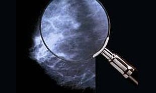 Оправдана ли регулярная маммография?